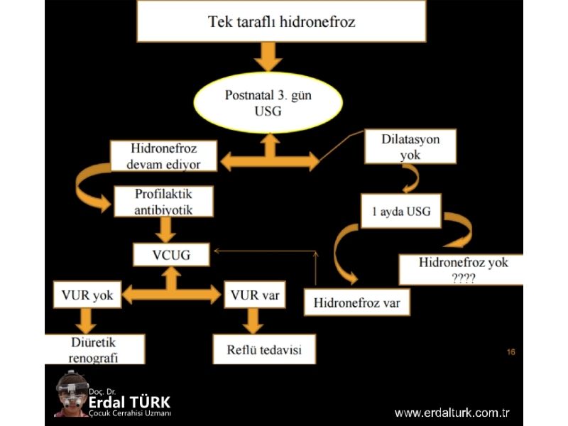 ureteropelvik-darlik-ve-cerrahi-tedavisi-resim-01