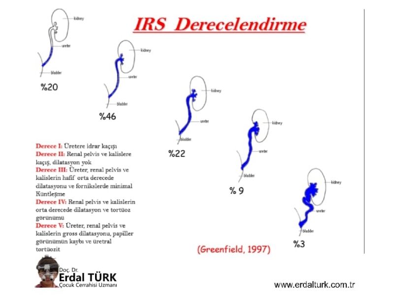 vezikouretereal-reflu-resim-01