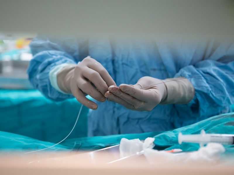 ameliyatin-nasil-yapilir