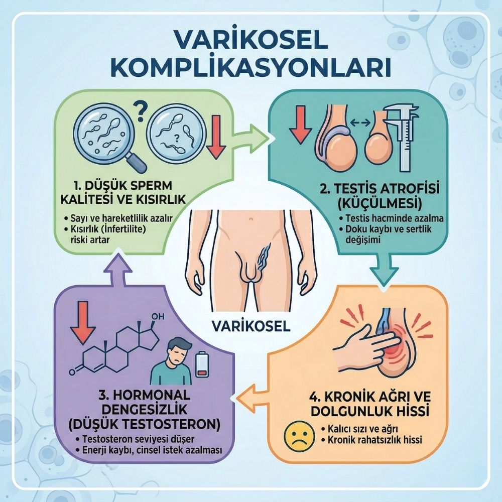grade 3 varikosel