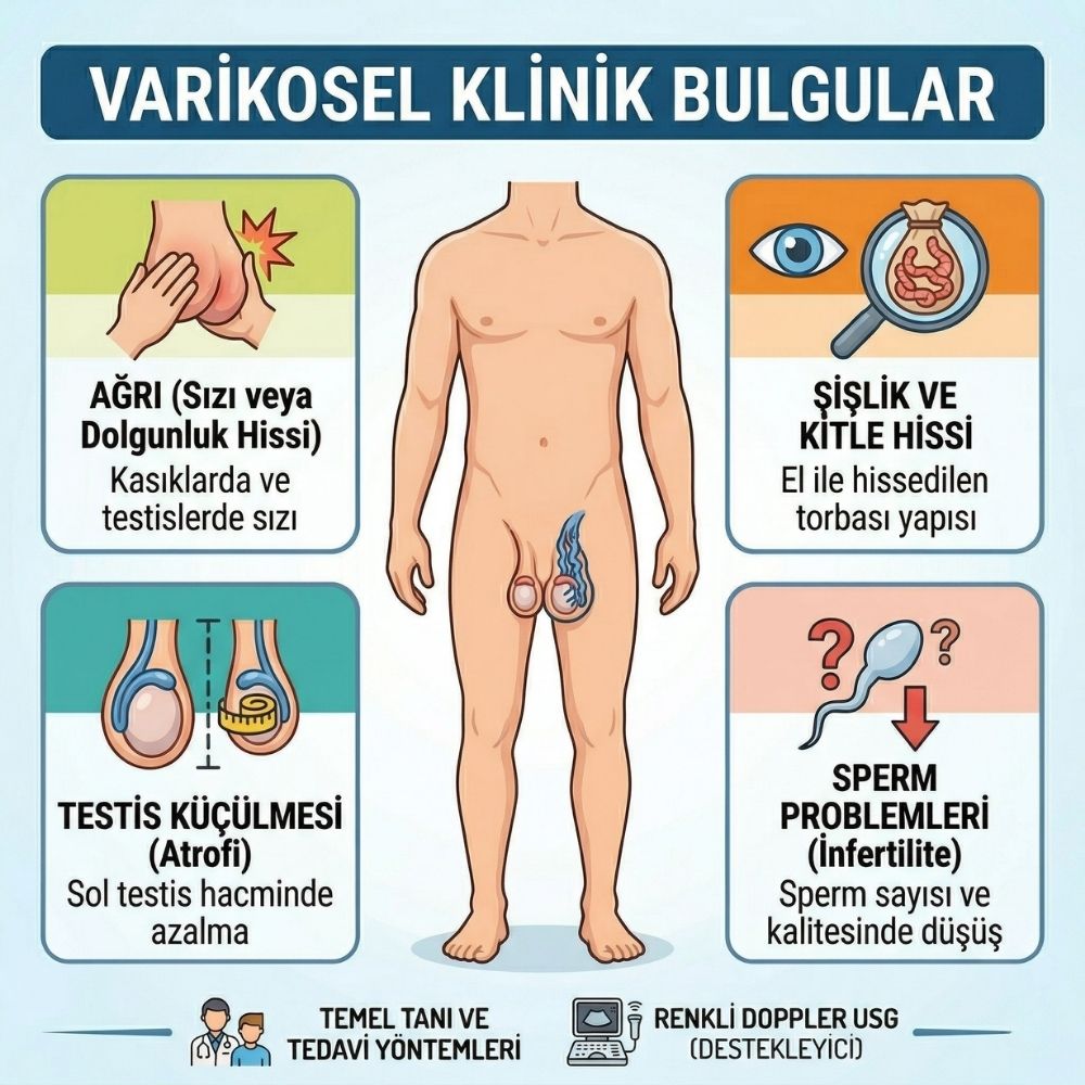 varikosel belirtileri