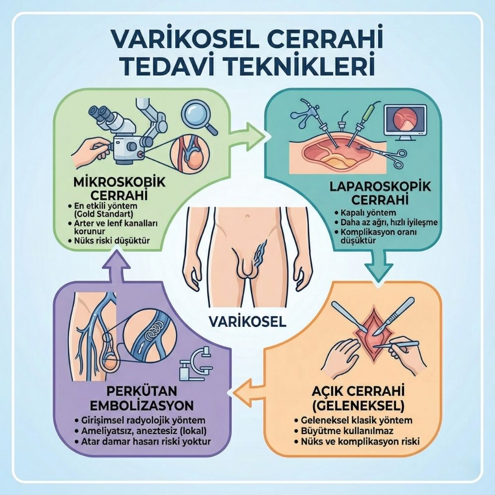 varikosel tedavisi