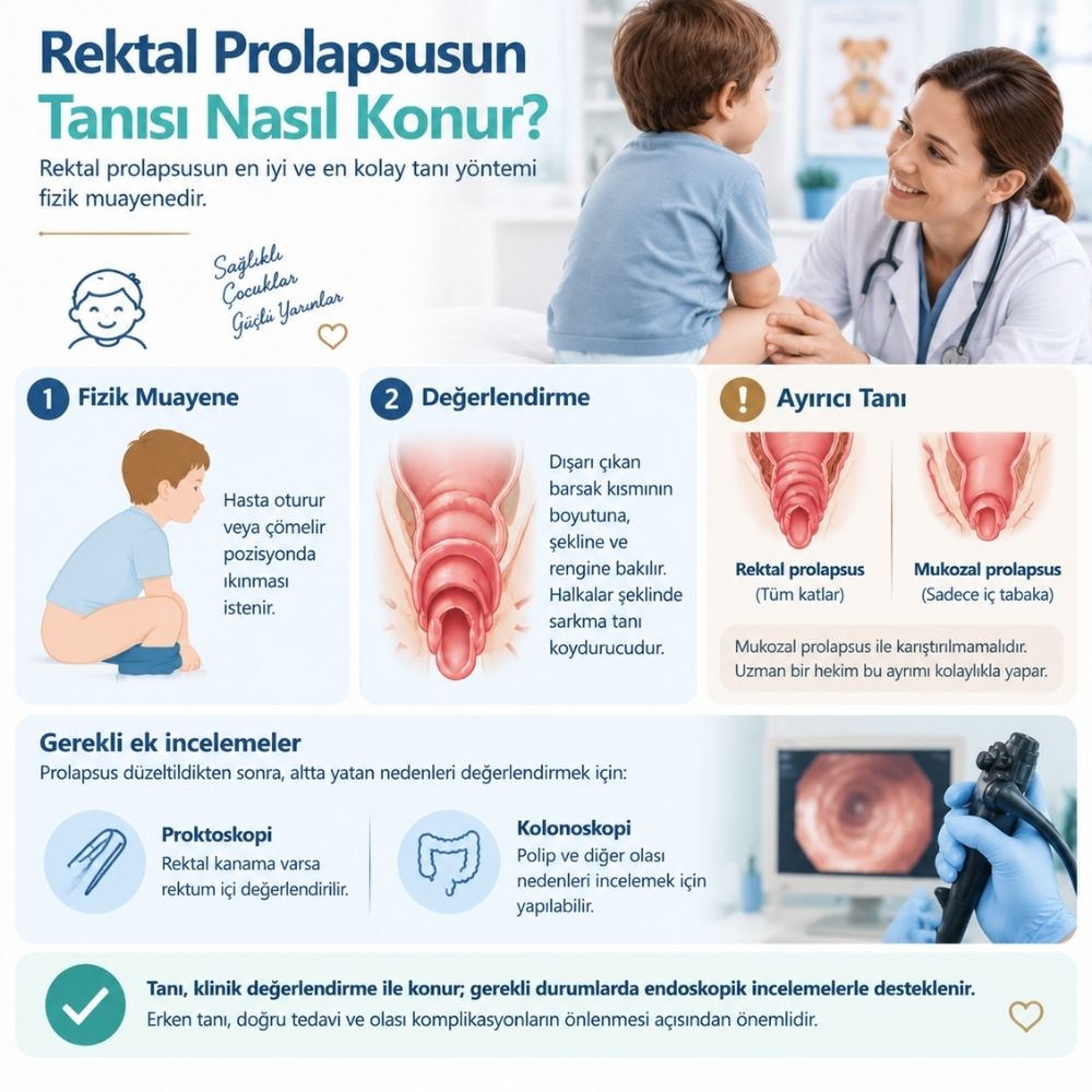 rektal prolapsus kadÄ±nlar kulÃ¼bÃ¼